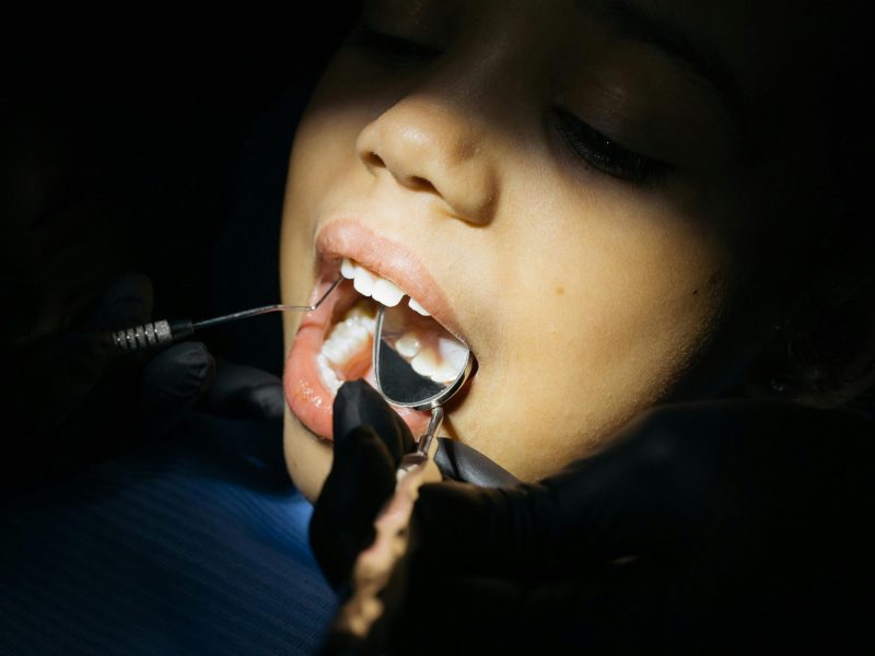 Dark-Coloured Saliva in Children